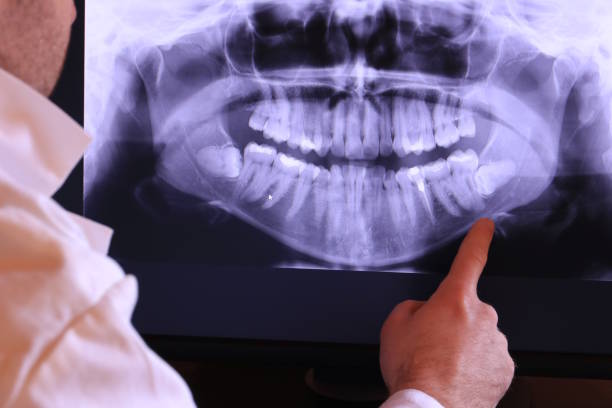 Best Emergency Broken Tooth Repair in Mabscott, WV