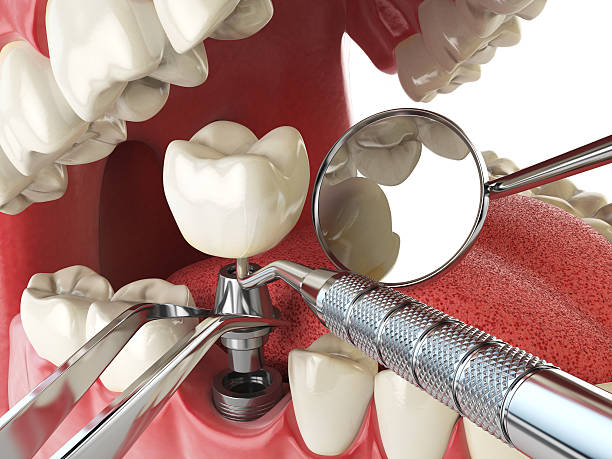 Best Emergency Tooth Extraction in Mabscott, WV